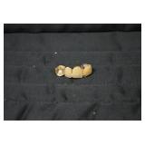 Gold teeth... Gold teeth...