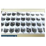 MSRP $4,000+. Lot of 3 3M ESPE Unitek Stainless Steel Crown Kits. Professional inventory for molars & bicuspids. Pre-crimped for "snap-fit" efficiency. Saves time, ensures durability & superio