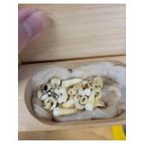 Dental Training Jaw Models - Assorted Casts & Partial Denture Sets in Wooden Box