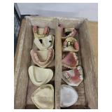Dental Training Jaw Models - Assorted Casts & Partial Denture Sets in Wooden Box