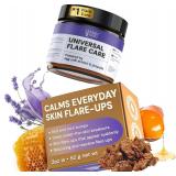 MyMagicHealer Universal Flare Care   2 oz