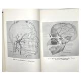 Robert Ryan 1954 Headache Diagnosis & Treatment