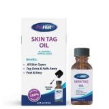 ProVent Skin Tag Remover 0.34oz
