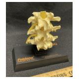 Lumbar Vertebrae Anatomical Model Feldene