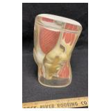 Merck & Co 1962 Knee Model Afflicted With Kneazles