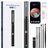 Ear Wax Removal Tool
