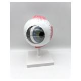 3B Scientific F10 Giant Eyeball Anatomical Model