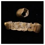 Dental gold