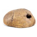 19th C Medical Cranium Specimen