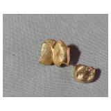 Dental Gold Filling