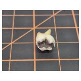 Tooth with gold filling