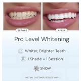 New DiamondSeriesï¿½ Teeth Whitening Kit