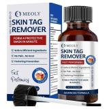 Skin Tag Remover: Skin Tag Remover with Salicylic Acid for Men and Women 30 ML