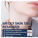 Skin Tag Remover: Skin Tag Remover with Salicylic Acid for Men and Women 30 ML
