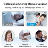 Chin Strap for Cpap Users Anti Snoring Devices - Forzacx Breathable Cpap Chin Strap Snoring Solution, Soft Non-Stick Hair Snore Stopper, Elastic Easy to Wear - White
