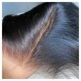 VINOVILLO 4x4 Skinlike Real HD Lace Closure Only Body Wave Ultra Thin Invisible Lace Virgin Human Hair Closure Pre Plucked Natural Hairline Sew In Closure Piece 18 Inch Natural Black