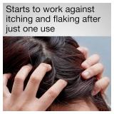 Neutrogena T/Gel Therapeutic Shampoo, Original Formula, 8.5 Ounce (Pack of 2)