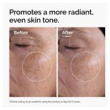 The Ordinary Glycolic Acid 7% Exfoliating Toner, Brightening and Smoothing Daily Toner for More Even-Looking Skin Tone, 8.1 Fl Oz