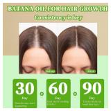 Batana Oil for Hair Growth, 100% Raw Batana Oil Dr Sebi Organic, Unrefined Sourced from Honduras, Batana Hair Mask Hair Growth Prevent Hair Loss for Men & Women