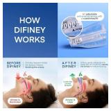 Difiney Anti Snoring Device-D6