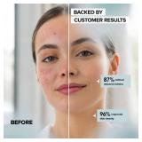 Face Towels - Ultra Soft and Thick Disposable Face Towelettes for Women - Biodegradable Facial Towels for Sensitive Skin - Face Cleansing, Makeup Removal, 10x12 Extra Large - 50 Pack