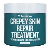 APPEARS NEW - (Packaging Varies) TreeActiv Crepey Skin Repair Cream, 8 oz, Firming Formula with Hyaluronic Acid & Shea Butter to Deeply Moisturize and Tighten Dry, Wrinkly Crepe Skin, 500+ Uses
