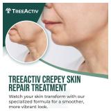 APPEARS NEW - (Packaging Varies) TreeActiv Crepey Skin Repair Cream, 8 oz, Firming Formula with Hyaluronic Acid & Shea Butter to Deeply Moisturize and Tighten Dry, Wrinkly Crepe Skin, 500+ Uses