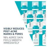 CeraVe Resurfacing Retinol Serum For Post Acne Marks, Formulated With Licorice Root Extract & Niacinamide, Brightening Serum & Pore Minimizer For Face, Post Acne Skin Barrier Repair, Non-Comedogenic
