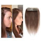 Meiverah scar human hair replacement Accidental burns without hair for men women Hairline Loss Straight Tape in Replacement Toupee (Medium Brown, 0.78\"x3\")