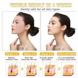 WAYCOM Facial Hair Remover Threading Hair Removal for Women Automatic Threader Machine Epilator for Fine Hairs on Face, Chin, Upper Lip, Arms Birthday Mother