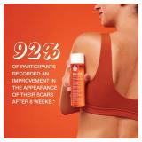 Bio-Oil Skincare Body Oil Serum, Face and Body Moisturizer with Vitamin E & A, for Scars, Stretch Marks, Sensitive Skin, All Skin Types, Dermatologist Recommended, Non-Comedogenic, 2 Oz