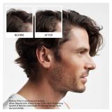 Nioxin Scalp + Hair Thickening System 2 Shampoo| For Natural or Untreated Hair with Progressed Thinning| With Niacinamide and Biotin| 33.8 Fl oz.