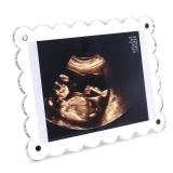 Mlatnod Magnetic Clear Acrylic Scalloped Baby Ultrasound Picture Frame - Sonogram Frame for Refrigerator, Display for Pregnancy Announcement, Gender Reveal & Expecting Parents Gifts(No Stand)