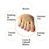Hoogoo 10 Pack Pinky Toe Sleeves Protectors, Toe Covers, Protect Toe from Rubbing, Ingrown Toenails, Corns, Blisters, Hammer Toes and Other Painful Toes Problems Translucent Colour - Retail: $9