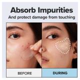 I DEW CARE Hydrocolloid Acne Patch-Blemish Chin, Tea Tree, 9 Count