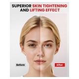 Rantxiny Face Massager Portable Charging Dock, Red Light Therapy for Face and Neck, 3 Heat Settings, Vibrating Face Massage, 9-Color & 30-Day Battery | Home Spa Travel Skincare - White - Retail: $30