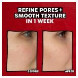 Thayers Natural Remedies 2% AHA Exfoliating Toner - 12 fl oz