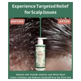 APPEARS NEW - X20Hair Deep Conditioner Scalp Treatment for Folliculitis - Relieves Dandruff, Psoriasis, Dryness & Itchiness, Balances Oil, Ideal for Women