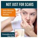 APPEARS NEW - NUVADERMIS Silicone Scar Sheets â Extra Long Medical-Grade Scar Sheets for C-Section, Tummy Tuck, Keloid, and Surgical Scars â Reusable and Effective â Pack of 4 â Me