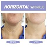 Irismistx Neck Cream, Neck Creams for Tightening and Firming, Anti Aging Tighten & Lift Face Cream for Wrinkles, Skin Tightening Cream for Face, Neck, Chest & Decollete