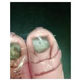 STQ KIDS Toddler Shoes Girls Wide Toe Box Barefoot Shoe Kids Walking Shoes Girl Sneakers Non-Slip Zero Drop First Walking Shoe Comfortable Pink Toddler5 - Retail: $23