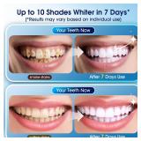Teeth Whitening Kit â 3 Teeth Whitening Pens + 2 Desensitizing Pens â LED Light â 35% Carbamide Peroxide â Safe & Dentist-Recommended â Fast 7-Day Visible Whitening + Reminera Teeth Whitening Kit â 3 Teeth Whitening Pens + 2 Desensitizing Pens â LED Light â 35% Carbamide Peroxide â Safe & Dentist-Recommended â Fast 7-Day Visible Whitening + Reminera