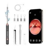 Tonsil Stone Remover with Camera Tonsil Stone Removal Tool with LED Light Tonsil Cleaner for Tonsil Stone Removal with 4 Head Attachments for iOS & Android (Black and Gold) - Retail: $24 Tonsil Stone Remover with Camera Tonsil Stone Removal Tool with LED Light Tonsil Cleaner for Tonsil Stone Removal with 4 Head Attachments for iOS & Android (Black and Gold) - Retail: $24