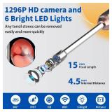 Tonsil Stone Remover with Camera Tonsil Stone Removal Tool with LED Light Tonsil Cleaner for Tonsil Stone Removal with 4 Head Attachments for iOS & Android (Black and Gold) - Retail: $24 Tonsil Stone Remover with Camera Tonsil Stone Removal Tool with LED Light Tonsil Cleaner for Tonsil Stone Removal with 4 Head Attachments for iOS & Android (Black and Gold) - Retail: $24