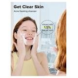 I DEW CARE Acne Foaming Cleanser - Salicylic 1.5% Facial Cleanser