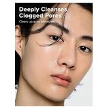 I DEW CARE Acne Foaming Cleanser - Salicylic 1.5% Facial Cleanser