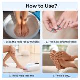 Home Toenail Repair Treatment for Multiple Toenails & Fingernails, Three Modes, Rechargeable