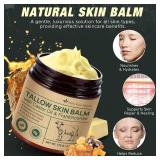 Beef Tallow for Skin & Face Cream with Castor Oil and Frankincense,120g,Organic Natural 100% Grass Fed,Whipped Beef Tallow Balm Deeply Moisturizing for Face & Body Care,4.2 oz