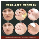 Beef Tallow for Skin & Face Cream with Castor Oil and Frankincense,120g,Organic Natural 100% Grass Fed,Whipped Beef Tallow Balm Deeply Moisturizing for Face & Body Care,4.2 oz