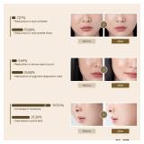 WELLDERMA Sapphire Collagen Impact Hydrogel Fitting Mask, 25g x 4 Sheets   Hydrating & Firming Micro-Hole Sheet Mask with Collagen Water 850,294ppm, Niacinamide & Peptides